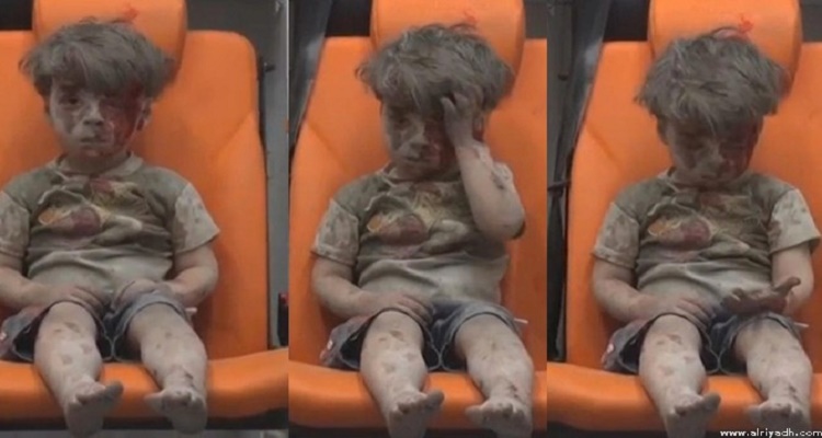 الطفل السورى عمران