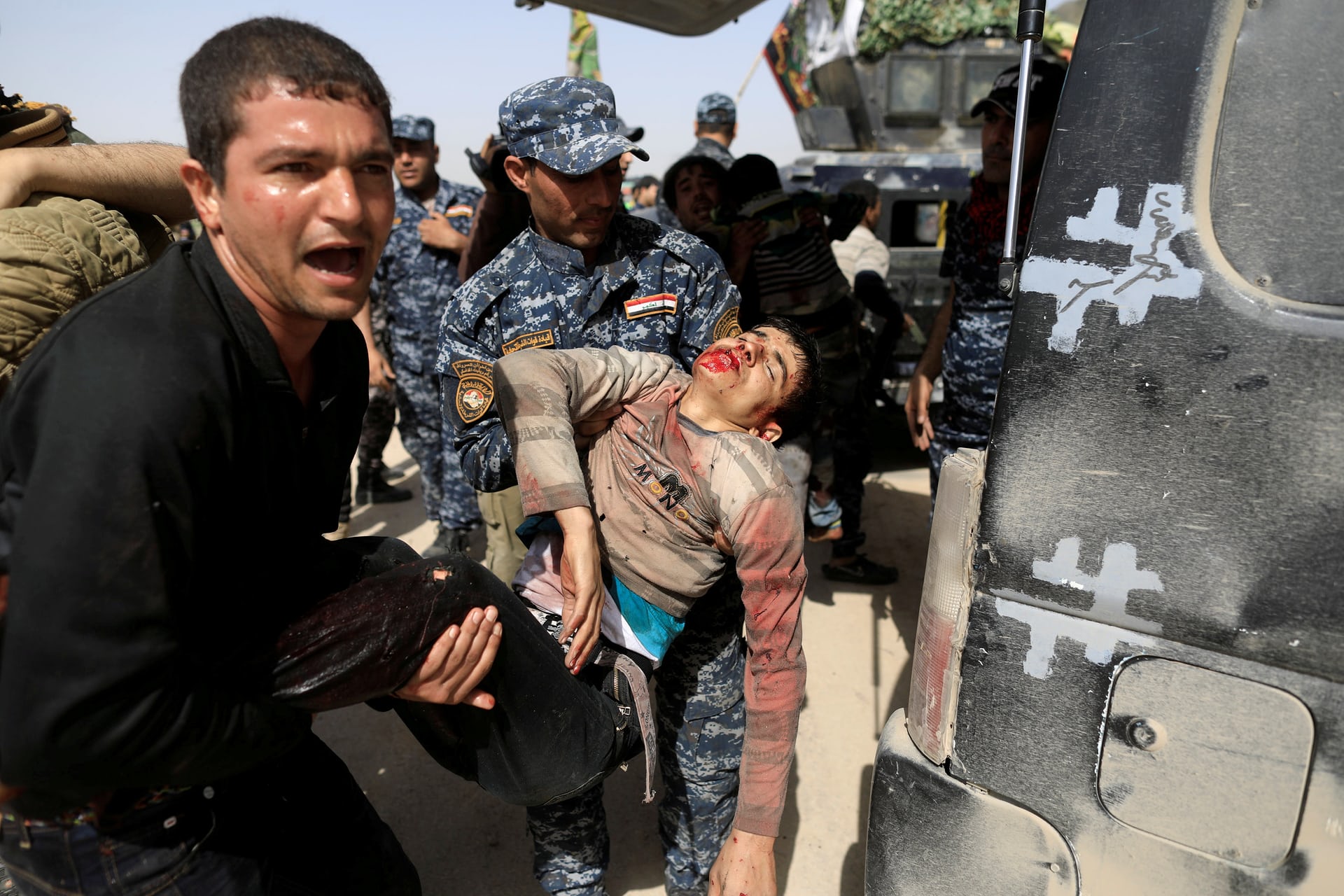 الشرطة العراقية تحمل طفل مصاب