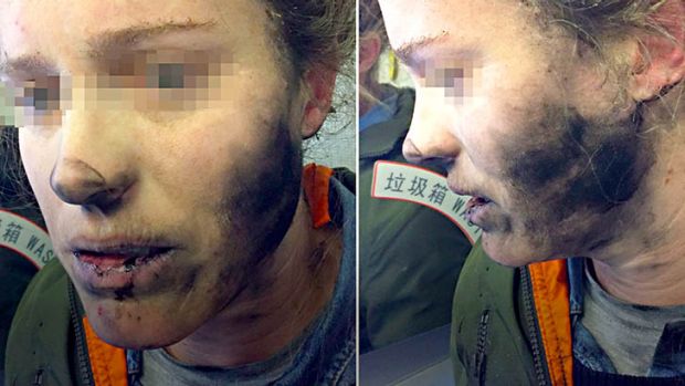 airline passenger burn headphone explodes during flight