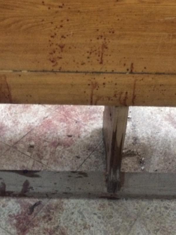 أثار الدماء على أحد المقاعد