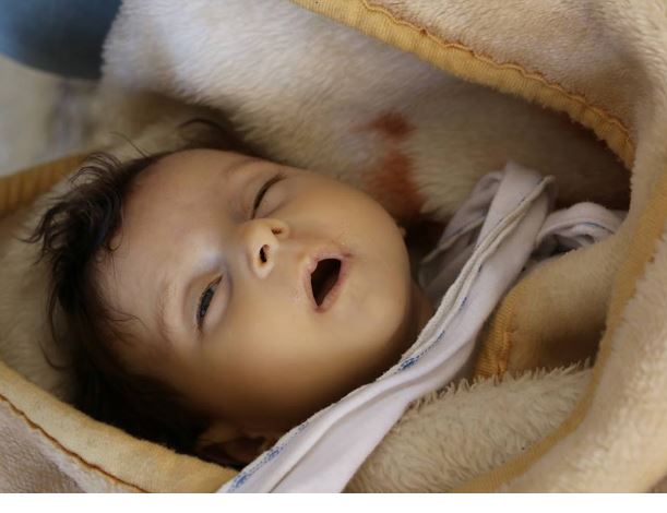 طفلة تودع الحياة بعد استنشاقها الغازات السامة