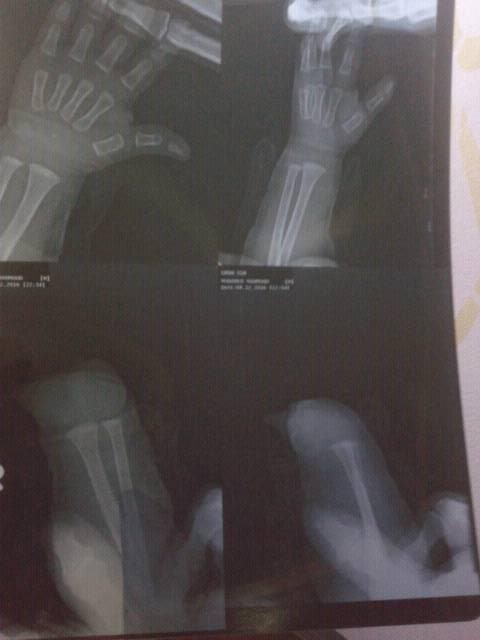 صورة الأشعة