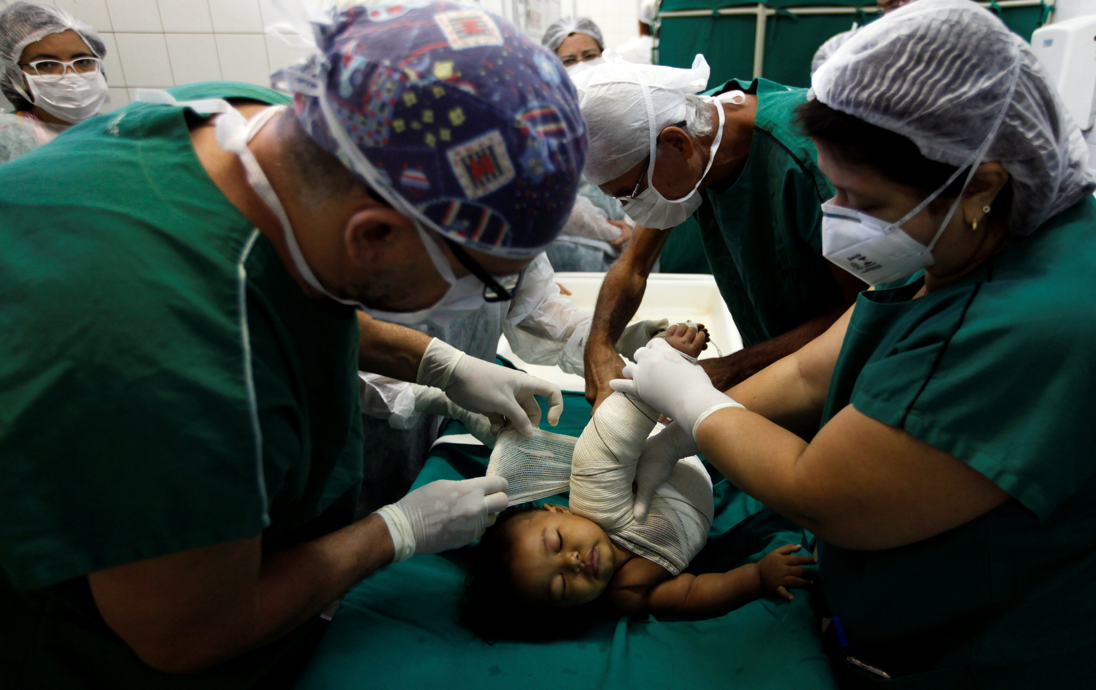 2017-05-25T140351Z_2096603458_RC130D775C10_RTRMADP_3_HEALTH-BRAZIL-BURNS