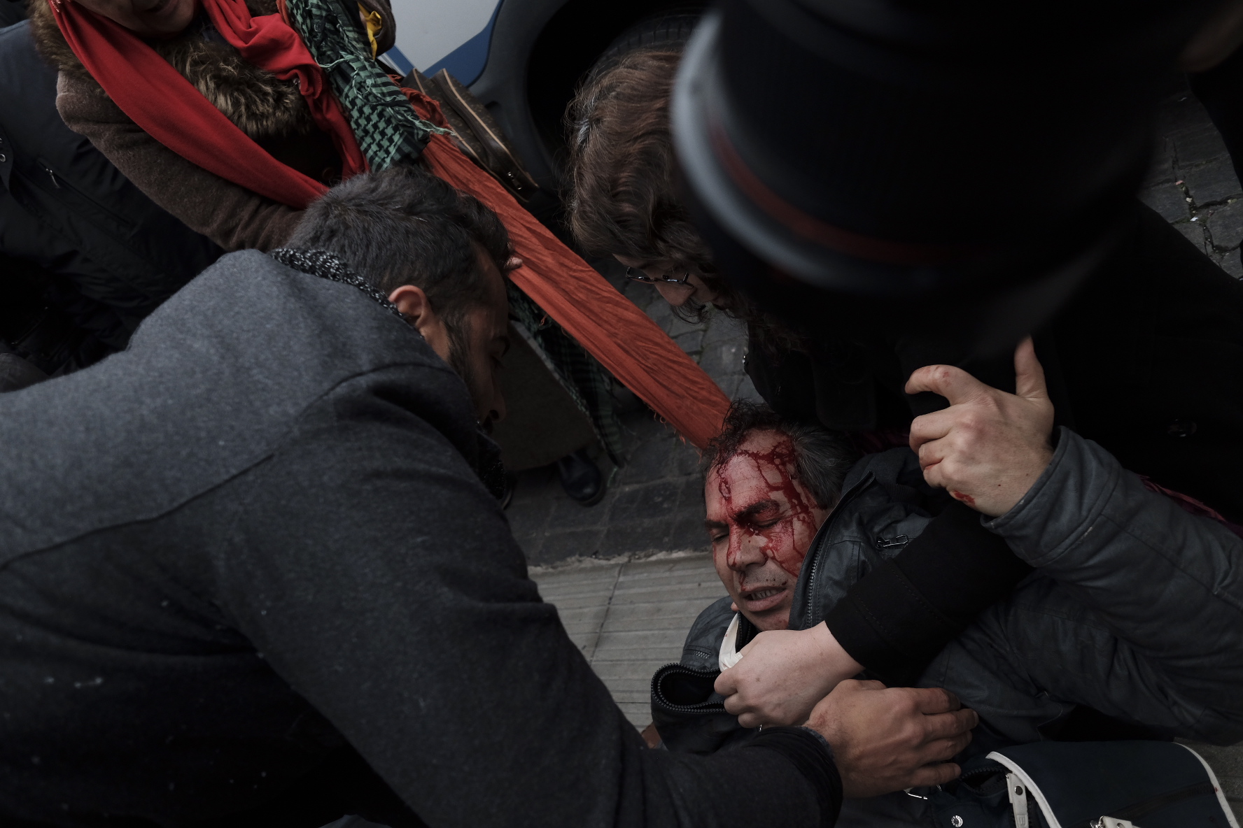 630957-الدماء-تسيل-من-رأس-أحد-المحتجين