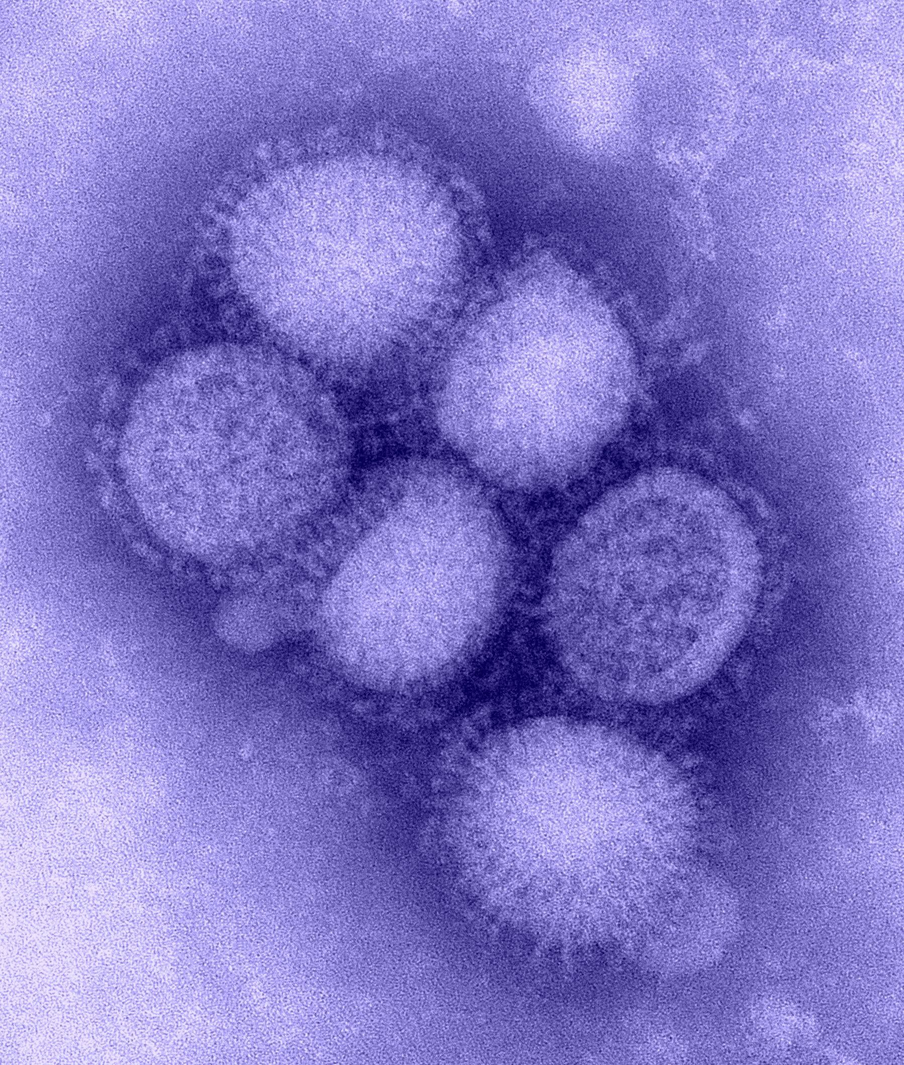 فيروس انفلونزا الخنازير