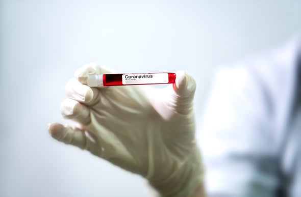 اختبار الدم لفيروس كورونا