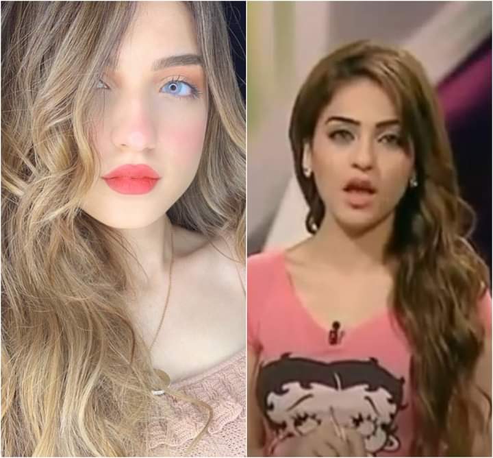 ياسمين عز تتصدر التريند.. بسبب صورها قبل وبعد عمليات التجميل | صوت الأمة