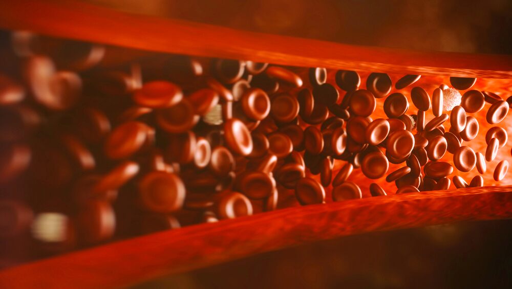 57608-World-Sickle-Cell-Day-2020-How-to-Manage-Sickle-Cell