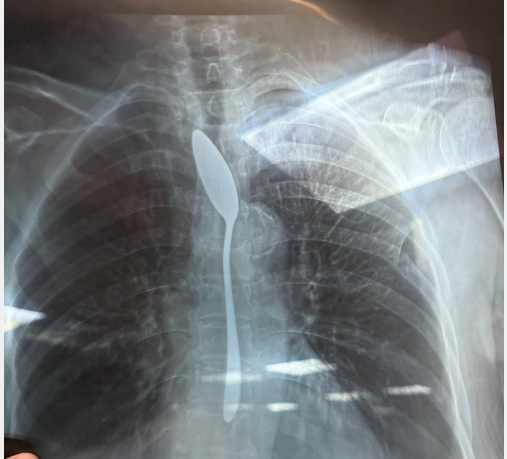 معلقة معلقة