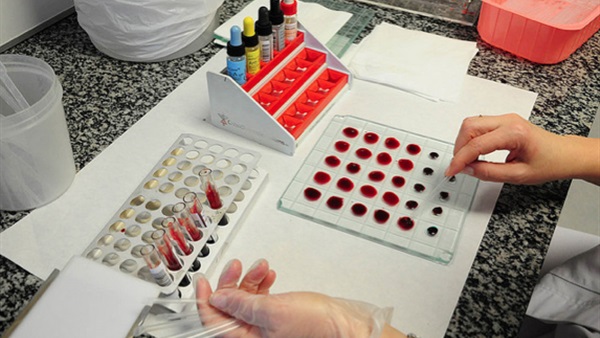 5 أطعمة يحظر تناولها على أصحاب فصيلة الدم "A"  