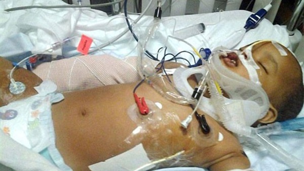 بالصورة.. نجاة طفل سقط من الطابق الـ18 بالصورة.. نجاة طفل سقط من الطابق الـ18
