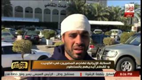 بالفيديو.. أحد ضحايا الإيرانيين يكشف تفاصيل تقطيع أصابعهم بالساطور بالفيديو.. أحد ضحايا الإيرانيين يكشف تفاصيل تقطيع أصابعهم بالساطور