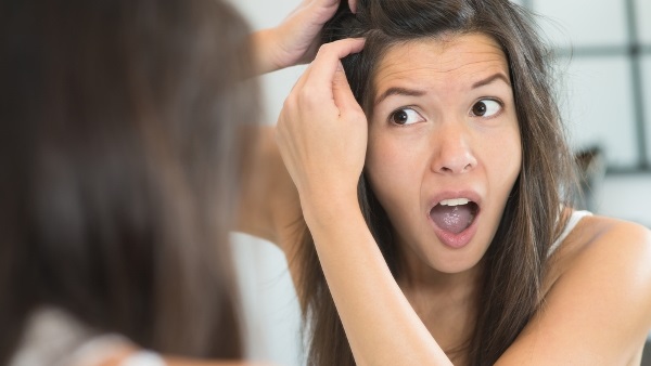 الليمون.. سلاحك للقضاء على قشرة الشعر