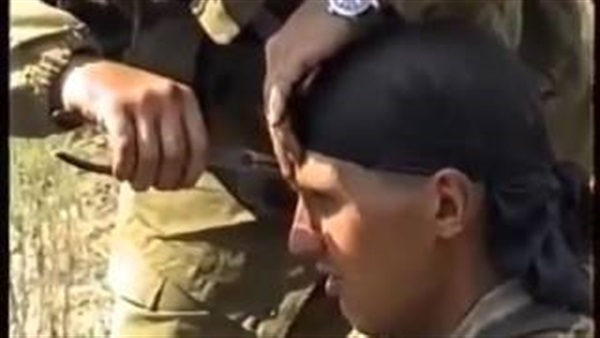 بالفيديو.. لحظة إخراج رصاصة من رأس جندي حي