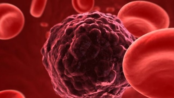 طويل القامة أكثر عرضة للإصابة بالسرطان