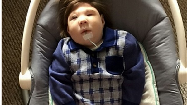 رضيع يُذهل الأطباء في ذكرى ميلاده الأول رضيع يُذهل الأطباء في ذكرى ميلاده الأول