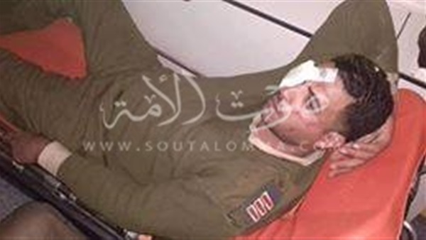بالصور.. إصابة أمينى شرطة بمياه نار فى الوجه بسوهاج بالصور.. إصابة أمينى شرطة بمياه نار فى الوجه بسوهاج