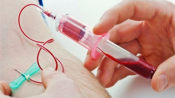 إختبار دم جديد يرصد عاهات القلب الوراثية