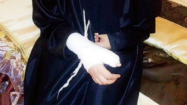 استبعاد مدرسة كسرت يد طالبة بمدرسة فى بنها استبعاد مدرسة كسرت يد طالبة بمدرسة فى بنها