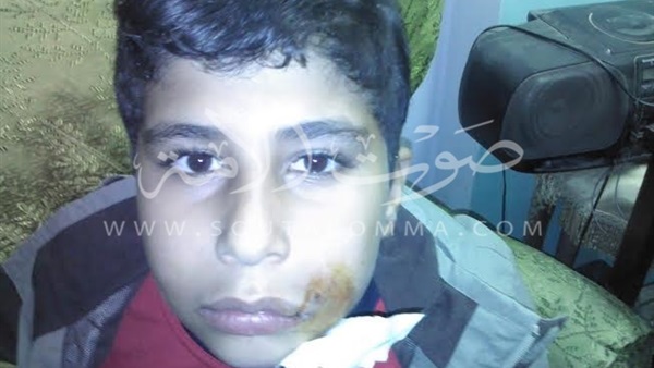 بالصور..عاملة مدرسة تعتدي بالضرب على طالب فى الفيوم بالصور..عاملة مدرسة تعتدي بالضرب على طالب فى الفيوم