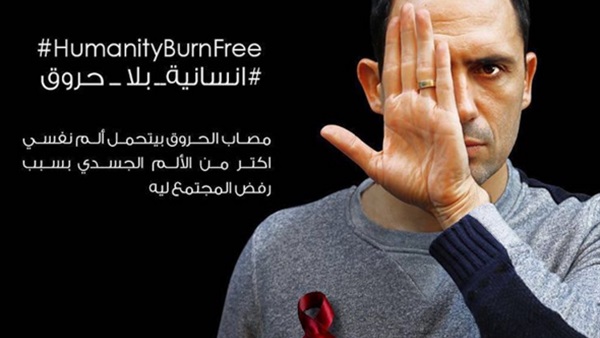 ظافر العابدين ينضم لحملة «إنسانية بلا حروق» ظافر العابدين ينضم لحملة «إنسانية بلا حروق»