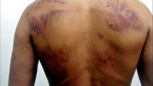 غداً.. محاكمة 5 متهمين بقتل شخص بعد تعذيبه غداً.. محاكمة 5 متهمين بقتل شخص بعد تعذيبه