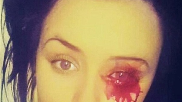 بالصور.. فتاة تنزف من جميع أنحاء جسدها بالصور.. فتاة تنزف من جميع أنحاء جسدها