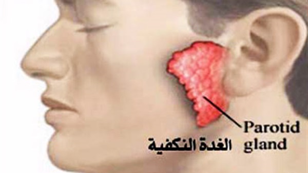 إصابة 38 طالباً بالغدة النكافية فى كفرالشيخ إصابة 38 طالباً بالغدة النكافية فى كفرالشيخ