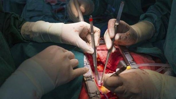 دراسة طبية: استبدال الشريان بالقلب أفضل من الجراحة