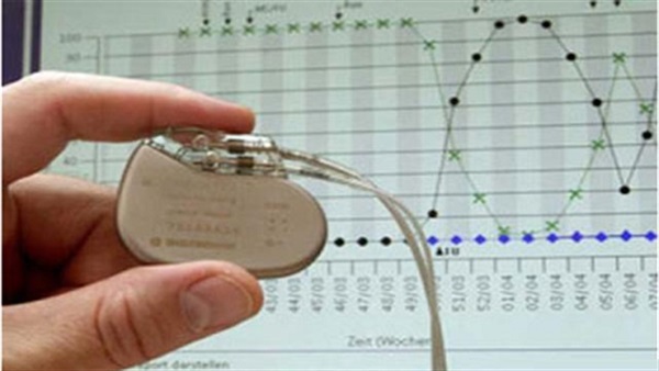 جهاز لاسلكي جديد لتنظيم ضربات القلب جهاز لاسلكي جديد لتنظيم ضربات القلب