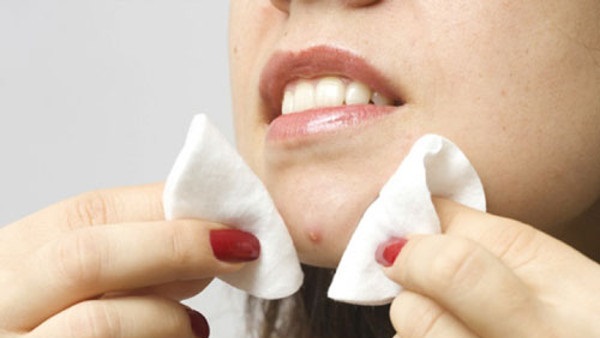 سيطرى علي «حب الشباب» أثناء فترة الحيض 