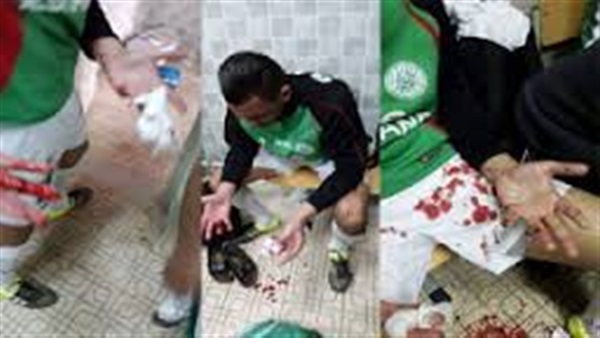 بالفيديو.. أعمال الشغب في الجزائر تستقبل «الزمالك» قبل مواجهة «بجاية» بالفيديو.. أعمال الشغب في الجزائر تستقبل «الزمالك» قبل مواجهة «بجاية»