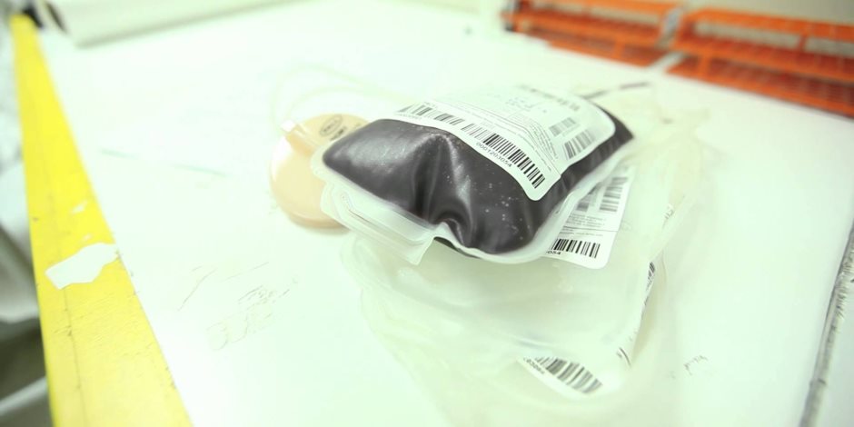 مدير خدمات نقل الدم: المستشفيات الخاصة تبيعه بـ700 جنيه وتحصل عليه مدعمًا بـ90