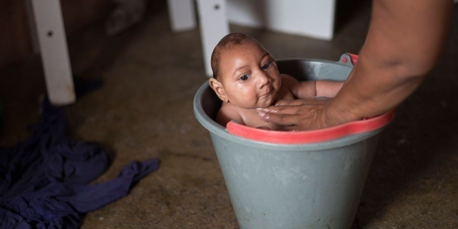 بسبب زيكا.. ولادة 50 طفلًا مصابًا بصغر الرأس فى جواتيمالا