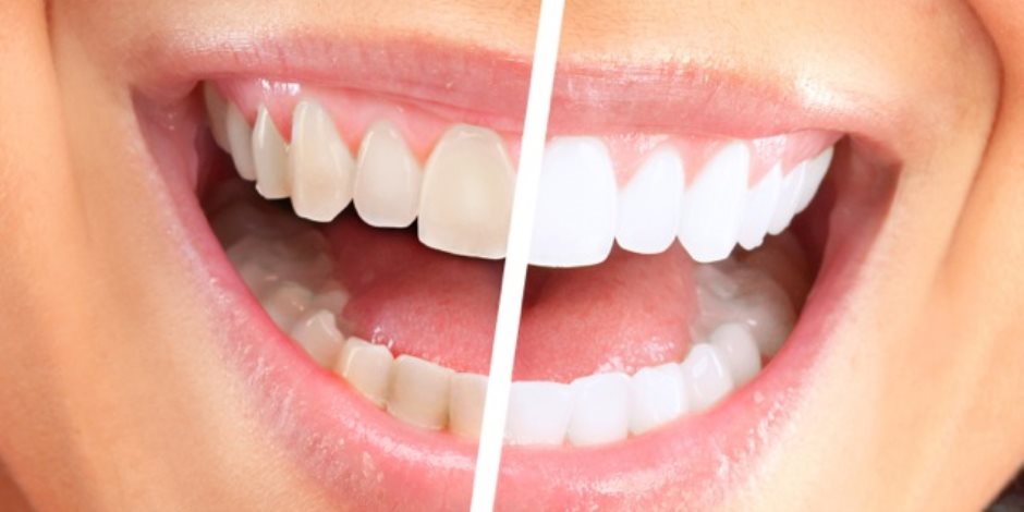 8 طرق منزلية سهلة وطبيعية لتبييض الأسنان (فيديوجراف)