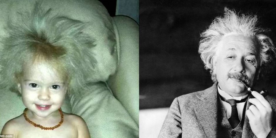 أنثى الاينشتاين.. رحلة بحث طويل قطعتها أم لتعرف سبب شكل شعر ابنتها الغريب 