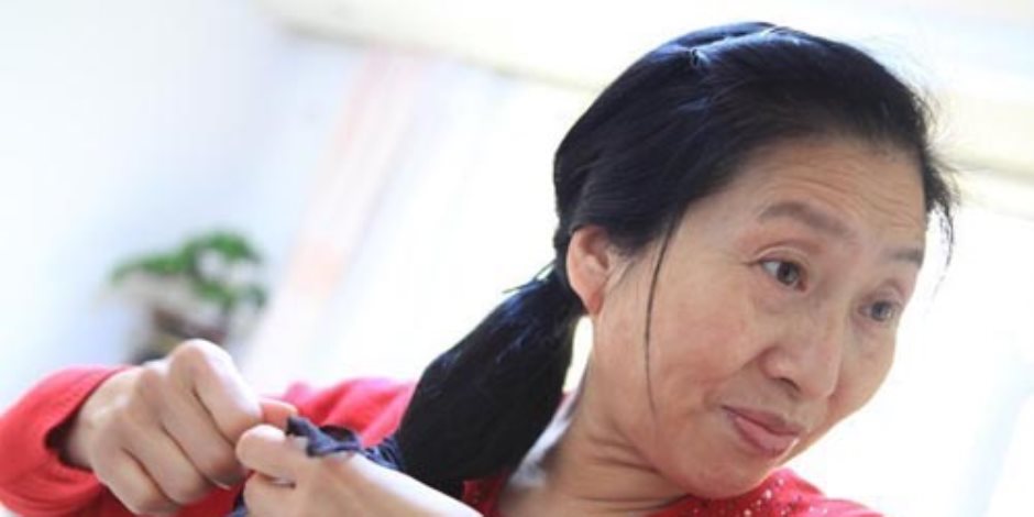 وسائل إعلام: امرأة صينية تخضع لجراحة تجميل لتفادى ديون قدرها 3.7 مليون دولار