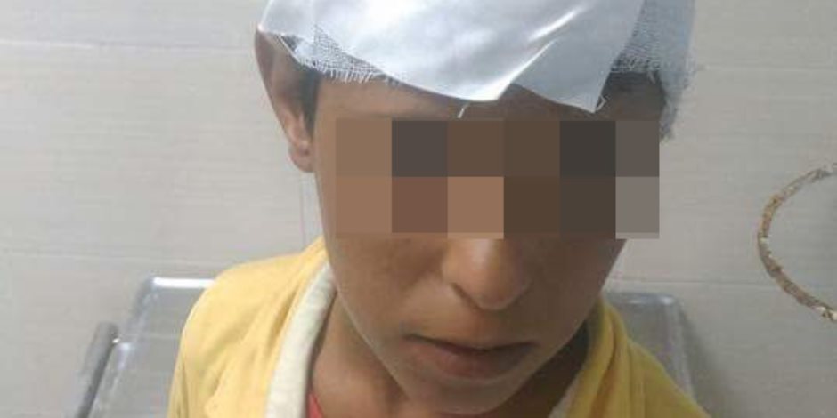 إصابة طفل بشظايا طلق ناري طائش بالشيخ زويد (صور)