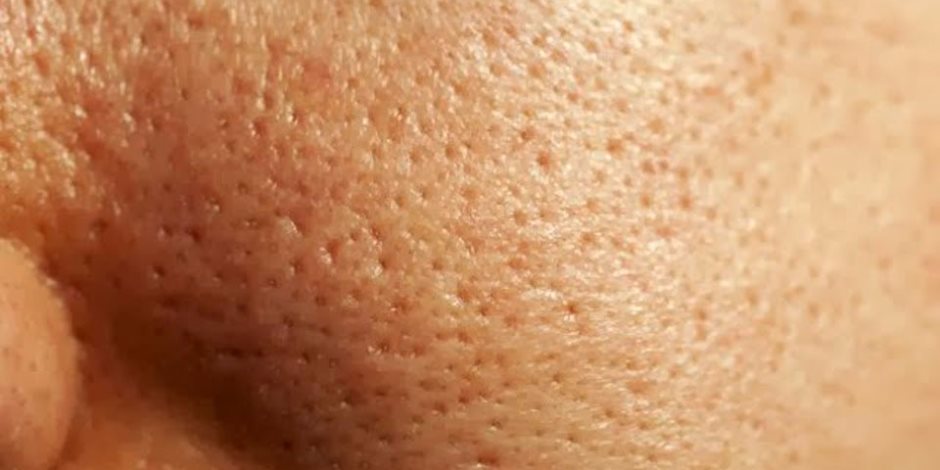 وصفات طبيعية للتقليل من مسامات الجلد الواسعة والحصول على بشرة رطبة