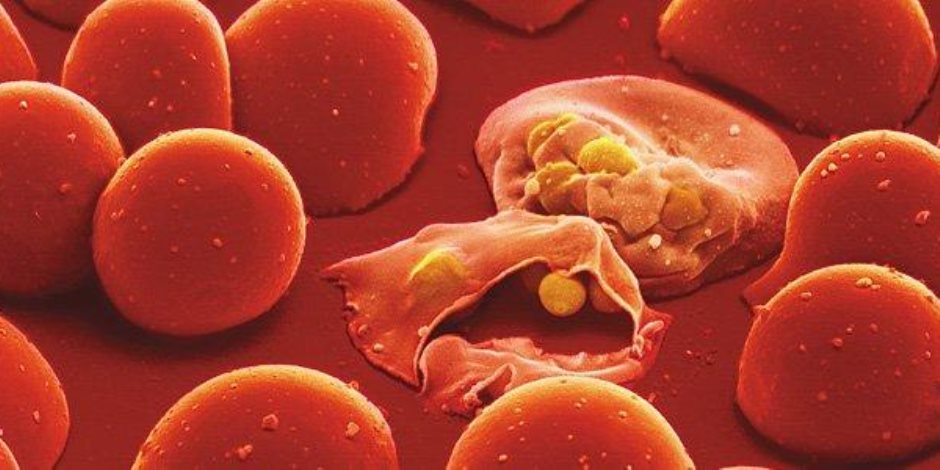 6 اختبارات لتشخيص إصابتك بالملاريا.. تعرف عليها