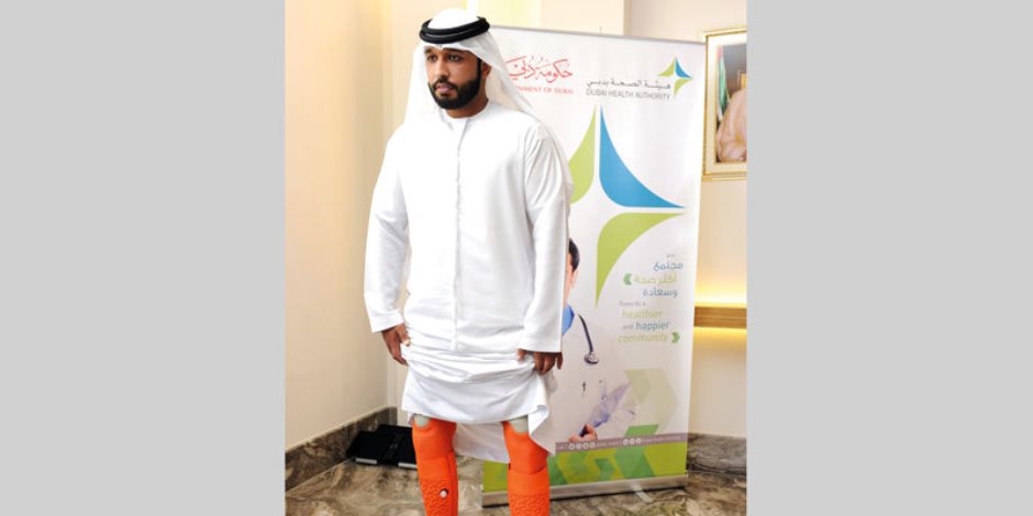 إنجاز جديد للإمارات.. «صحة دبي» تنتج ساقين اصطناعيتين لمواطن بالطباعة ثلاثية الأبعاد