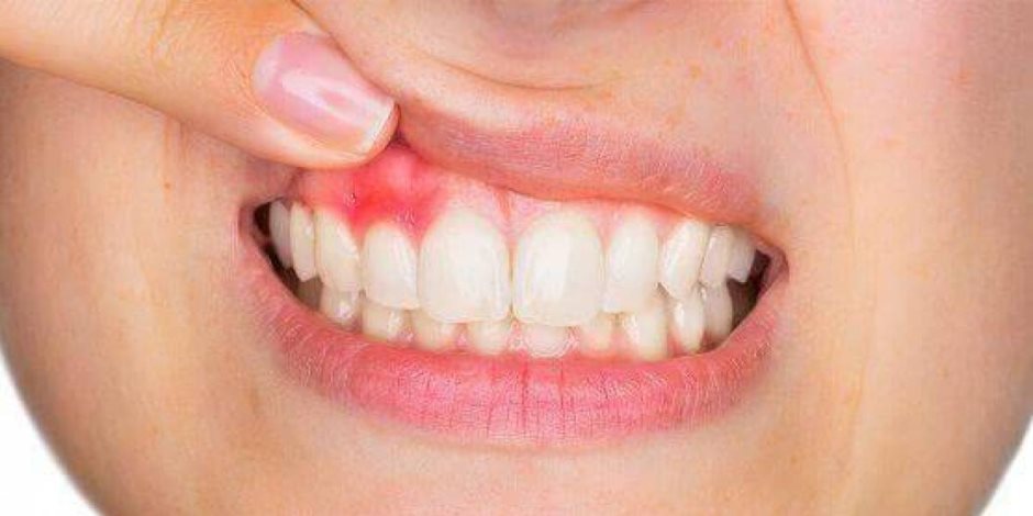 4 طرق للعناية بالفم وتبيض الأسنان والوقاية من فيروس كورونا 