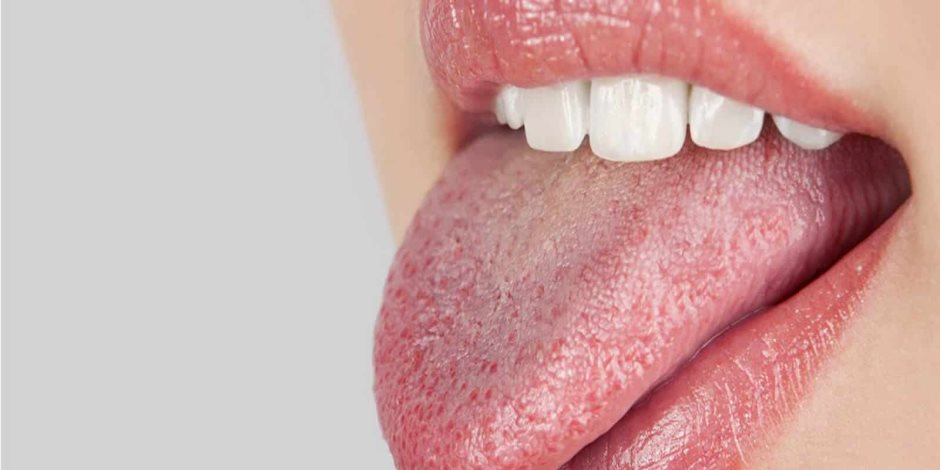 هل تعاني جفاف الفم؟.. عليك وعلى «اللبان» والسكريات