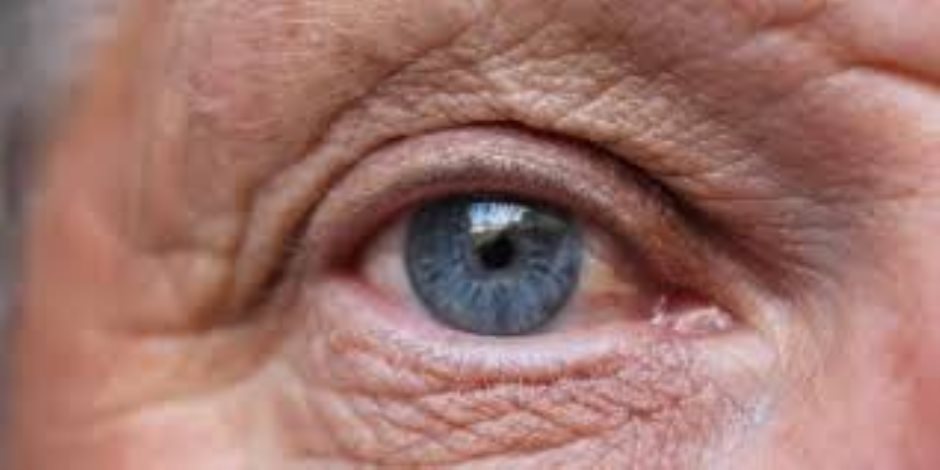 مرتبط بالسن.. تعرف على 5 طرق لتحسين الرؤية وعلاج التنكس البقعي 