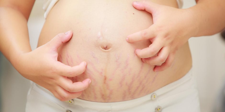 لكل أم.. 5 أسباب وراء الطفح الجلدى عند الأطفال تعرفي عليها