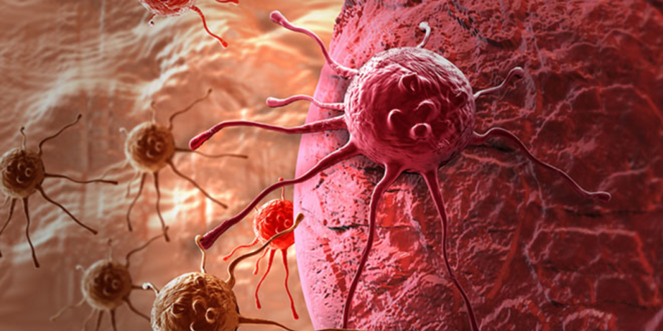 علاج سرطان الدم بالكيماوى والإشعاعى والبيولوجى