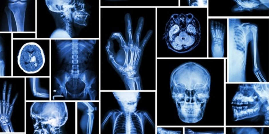 الأشعة السينية أو الإكس راي: تكشف الخلل ولا تؤذي