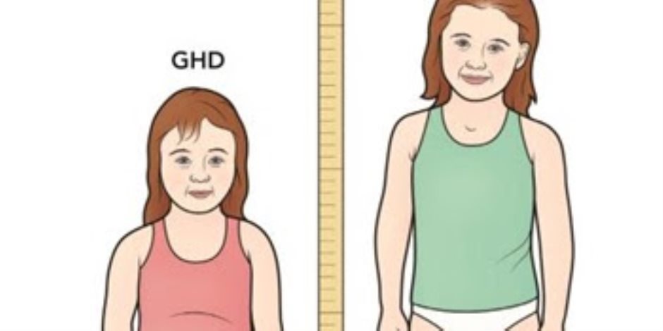 هل تساعد بعض الأطعمة على زيادة طول طفلك؟
