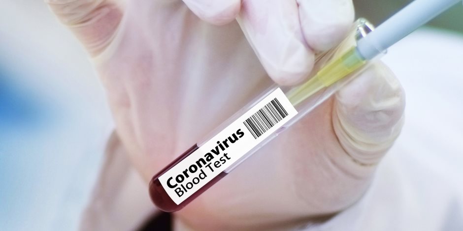 دراسة تشعل الجدل حول فعالية الكمامات ضد فيروس كورونا