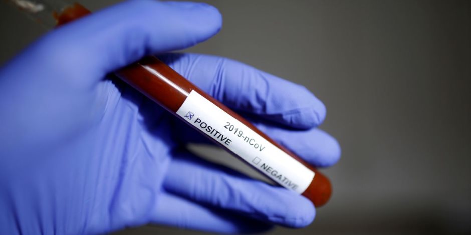 هل يصل وباء كورونا لمستوى الأنفلونزا الإسبانية؟